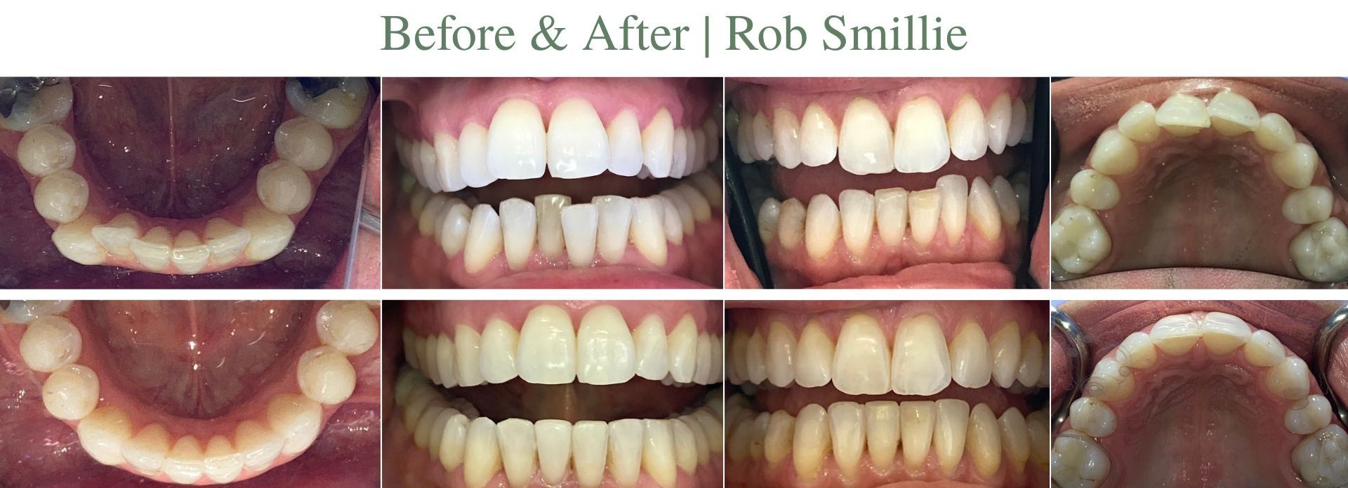 Rob before and after