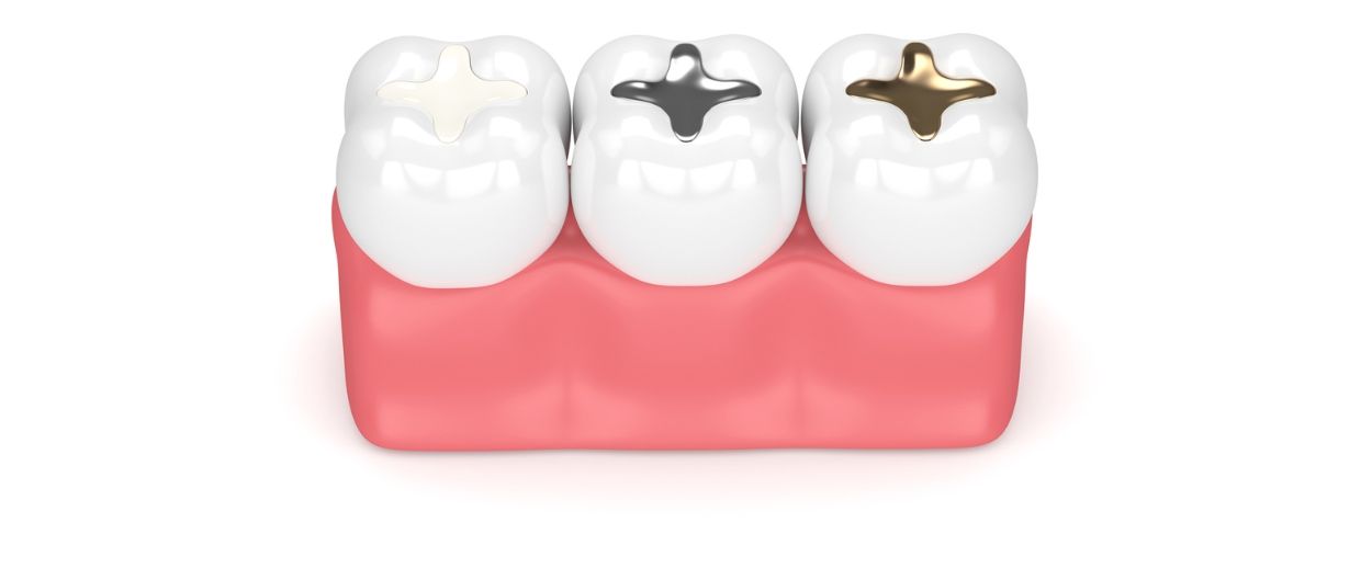 Fillings